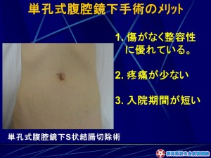 スライド22