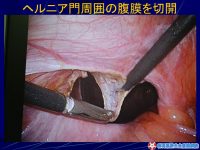 スライド31