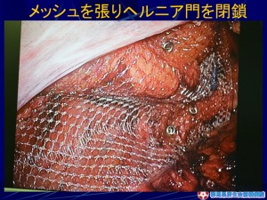スライド32