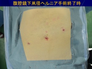 スライド34